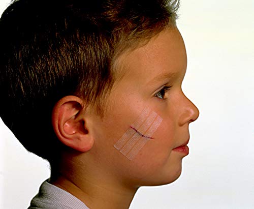 Nexcare Steri-Strip Wound Closure, Breathable Strips Hold Small Wounds Firmly Closed, Great After Sutures or Staples - 30 Wound Closures